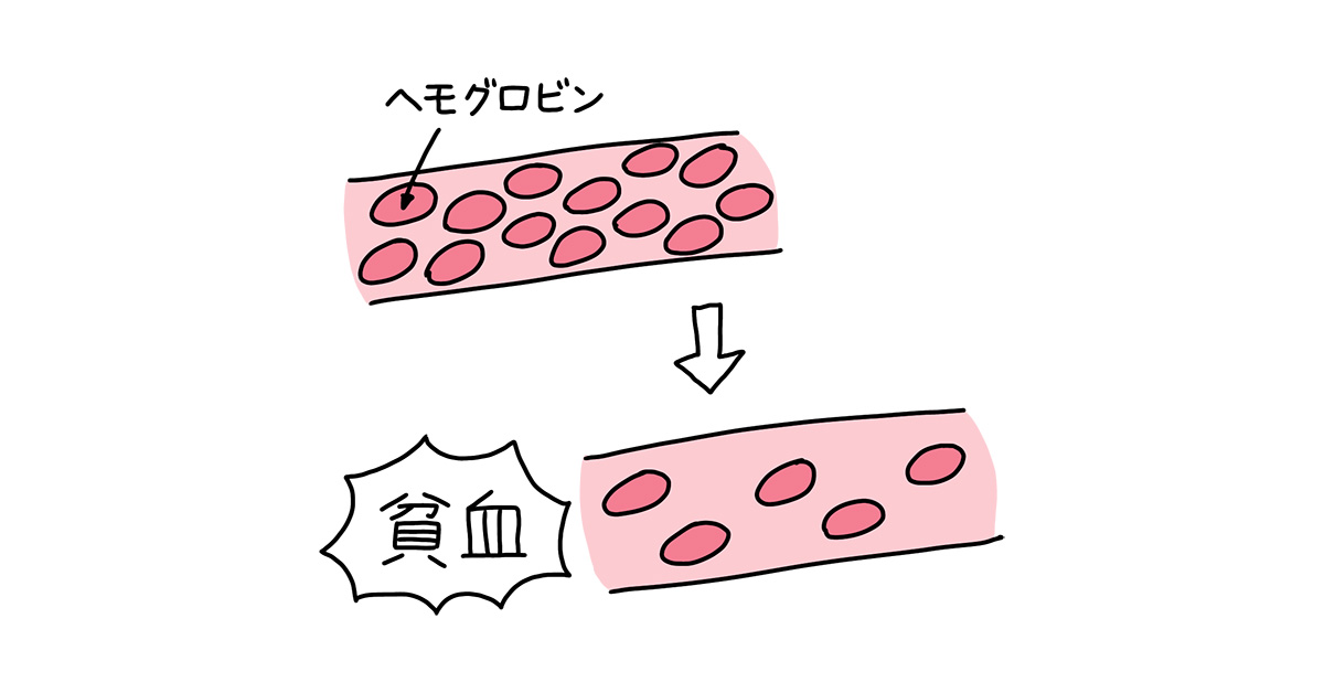 三位血液學家發現「吃肝臟，治貧血」而榮獲諾貝爾獎